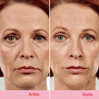 Fita Lifting Facial Adesiva para V-Face Anti Rugas