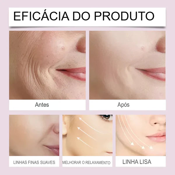 Fita Lifting Facial Adesiva para V-Face Anti Rugas