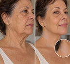 BeutyLift - Adesivo para rugas no pescoço
