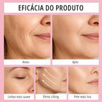 Fita Lifting Facial Adesiva — Efeito V-Face Imediato