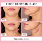 Fita Lifting Facial Adesiva — Efeito V-Face Imediato