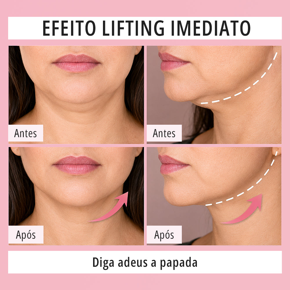Fita Lifting Facial Adesiva — Efeito V-Face Imediato