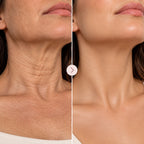 BeautyLift Pro – Massageador Facial LED Antirrugas e Lifting