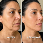 Gua Sha Beauty - Escova de Drenagem Efeito Lifting