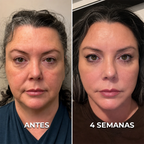 Gua Sha Beauty - Escova de Drenagem Efeito Lifting