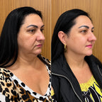 V-Lift - Máscara de Contorno Facial - Suaviza Rugas, Papada e Modela o Rosto