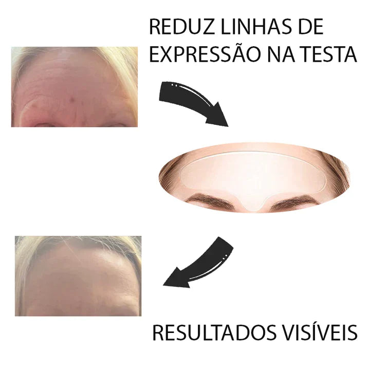 Adesivo Beauty - O Antirrugas Preferido das Famosas - storemundobeauty